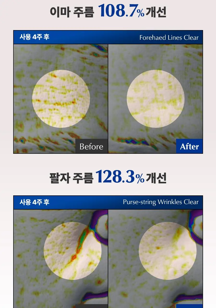 [크림증정/속광탄력] 닥터지 블랙 스네일 레티놀 앰플 50ml 증정 기획 (+스네일 크림 20ml+마스크팩 1매) 상세페이지 23